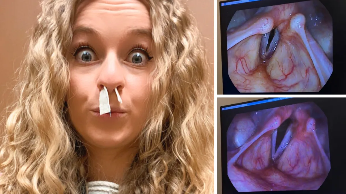 My Vocal Injury Story