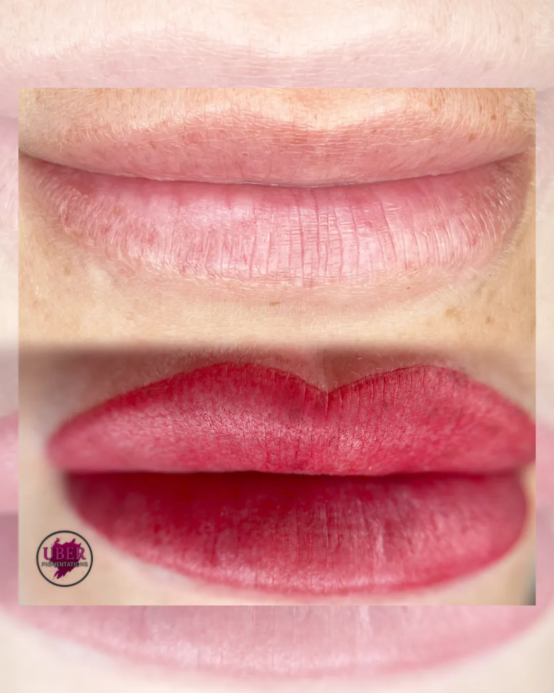 Lip Neutralization