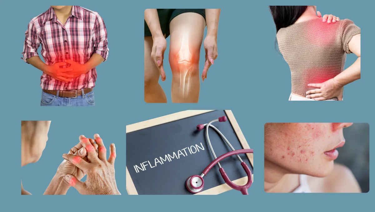 Signs of Inflammation