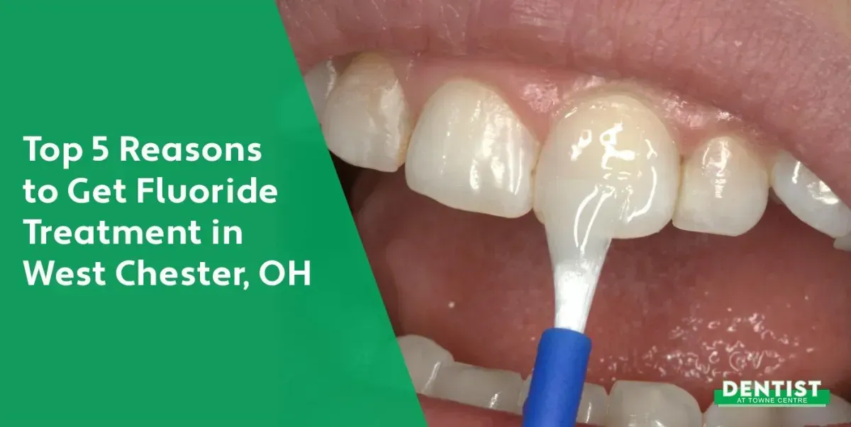 Top 5 Reasons to Get Fluoride Treatment in West Chester, OH
