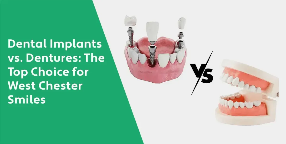 Missing Teeth? Here's Why West Chester Residents Choose Dental Implants over Dentures