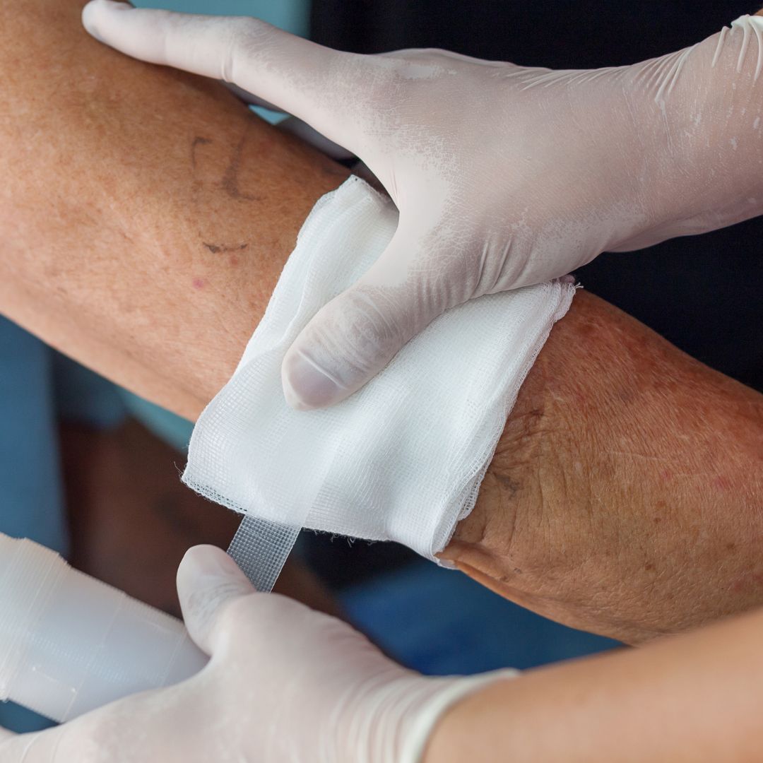 Wound Care Training for Nurses