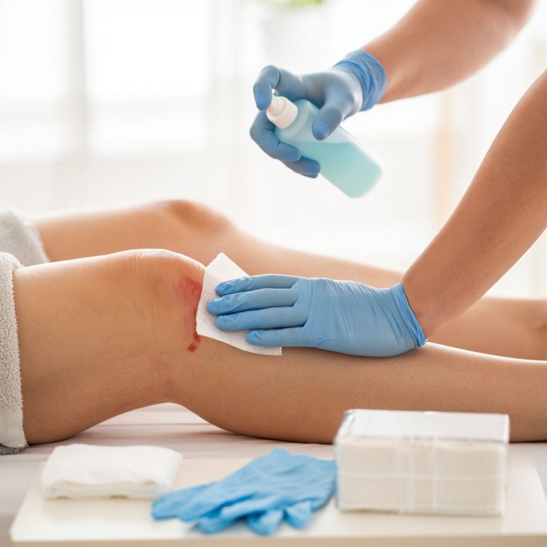 How to Remove Gauze Stuck to Wound Without Pain