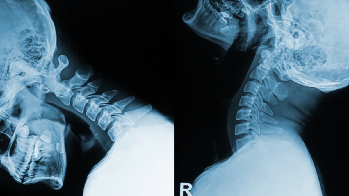 Decoding AOMSI: Insights into Spinal Health and Communication