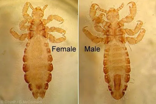 Head Lice Education: Anatomy, Biology, and Survival
