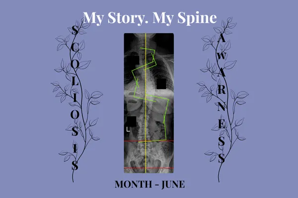 X-ray image of a spine with scoliosis, overlaid with green curvature lines and black privacy blocks. Surrounded by the words 'My Story. My Spine.' and 'Scoliosis Awareness Month – June' with decorative vines and vertical text reading 'Scoliosis' and 'Awareness'.