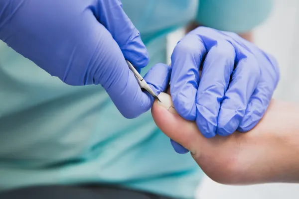 doctor trimming toe nails