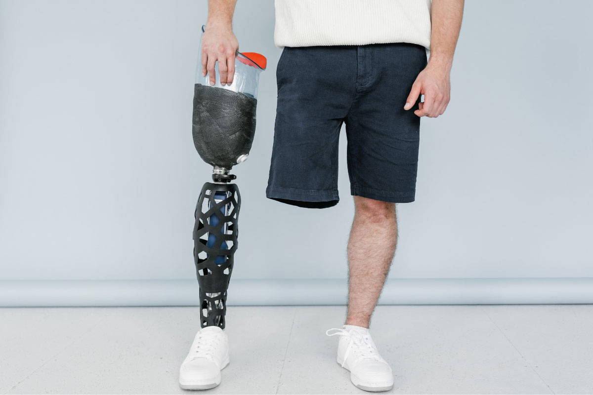 Man walking confidently with a custom prosthetic leg