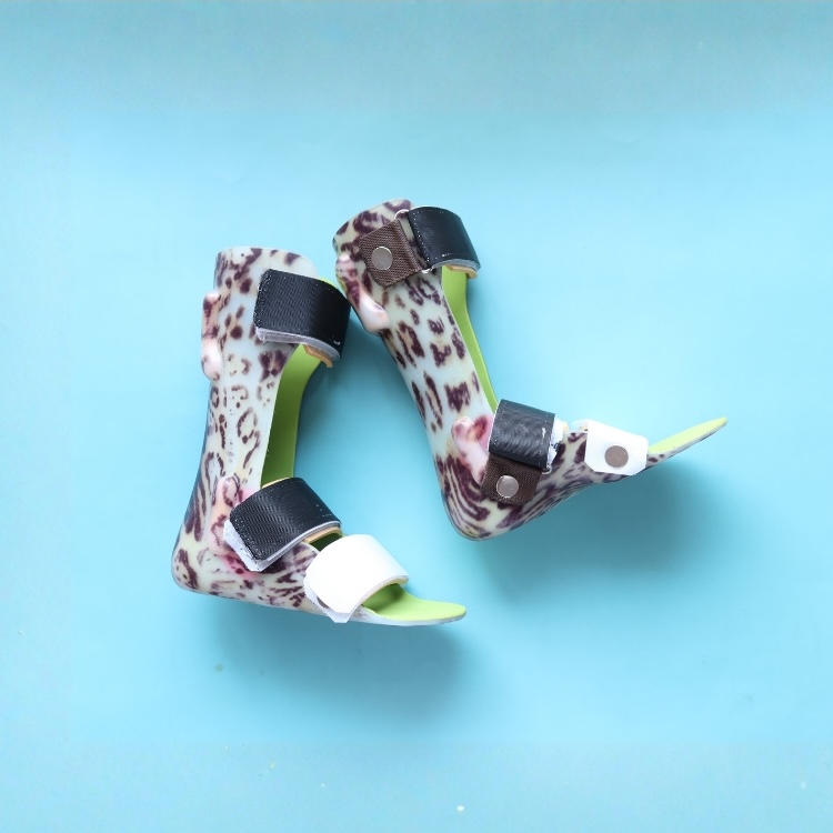 Benefits of Custom Orthotics: How Personalized Bracing Relieves Pain and Restores Mobility