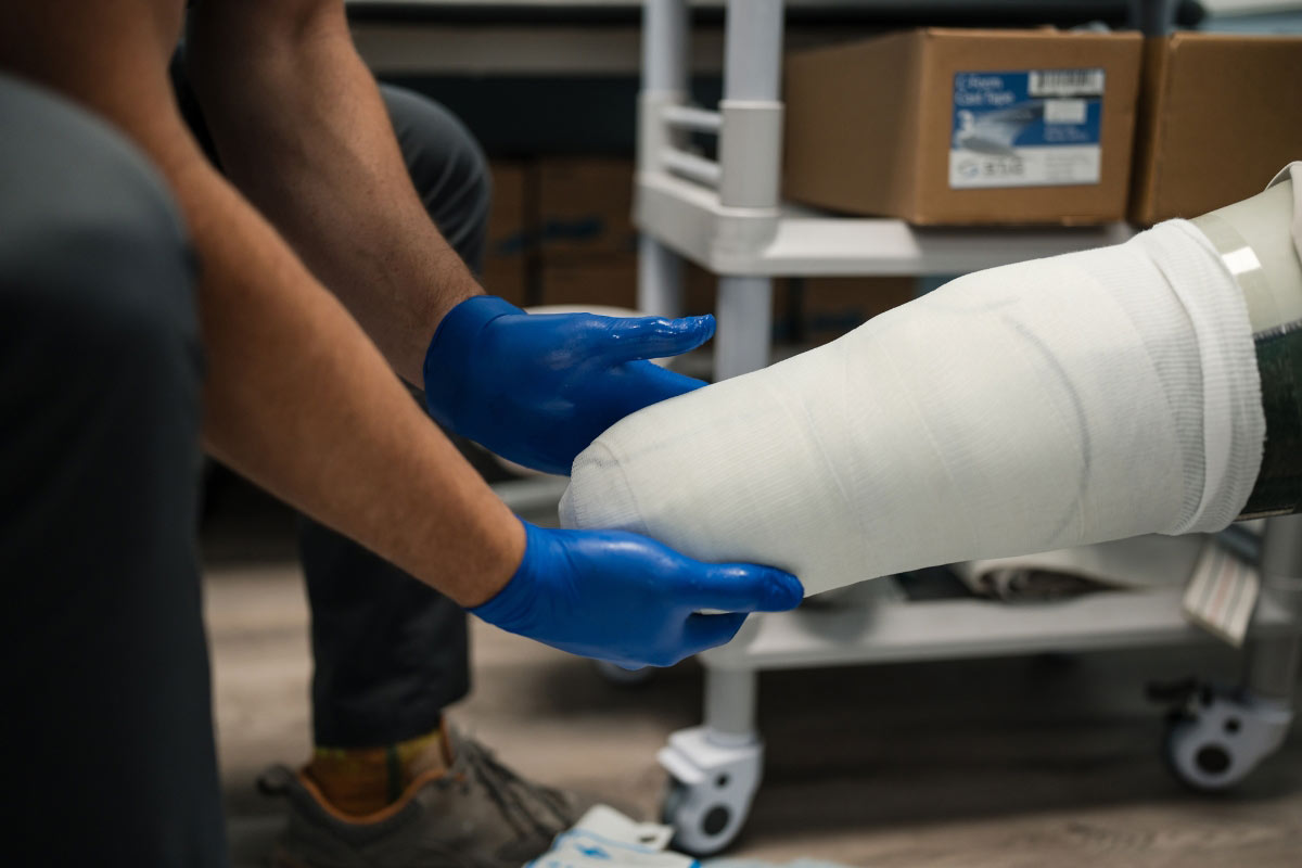 What to Expect After an Amputation: The First 90 Days