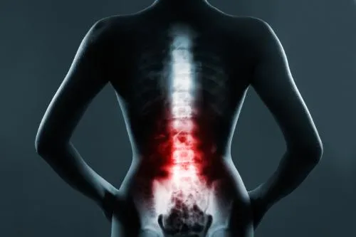 Can Chiropractic Care Help With Spinal Disc Problems?