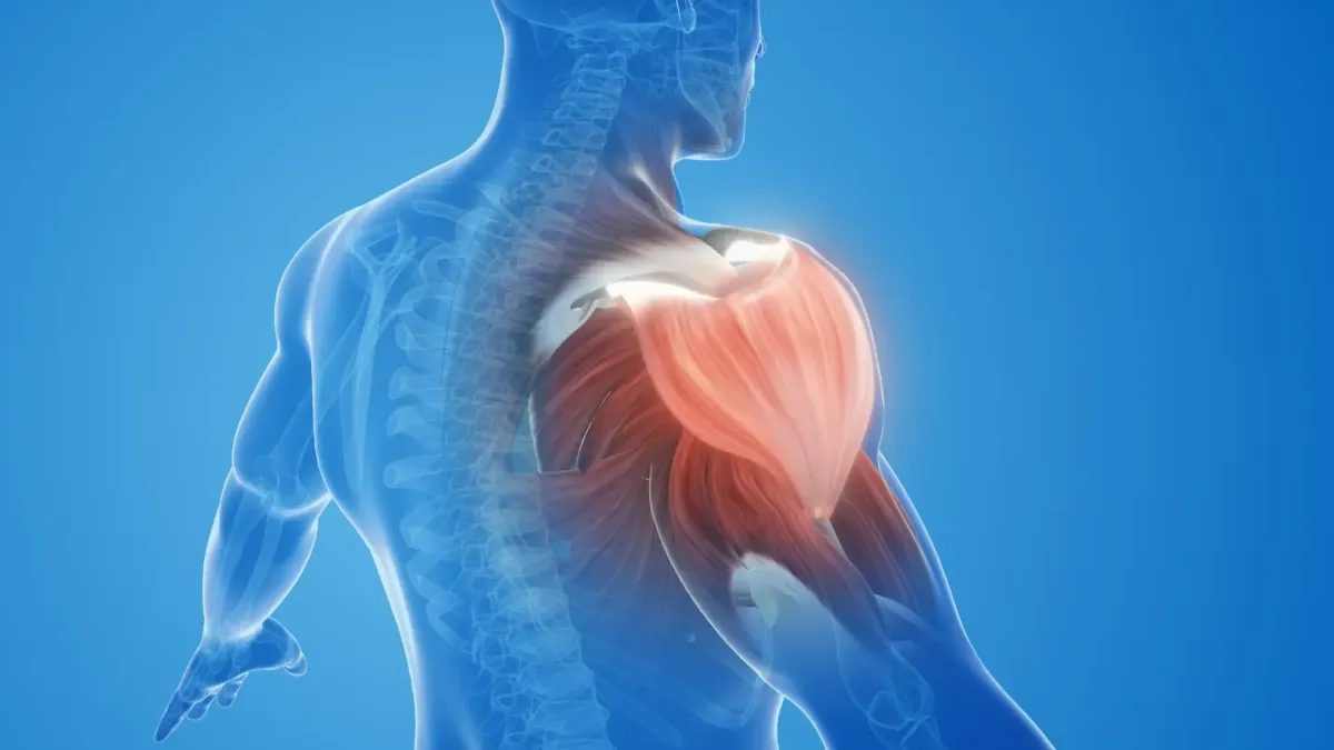 Frozen Shoulder