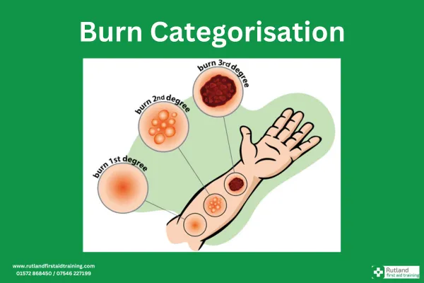 Burn Categorisation
