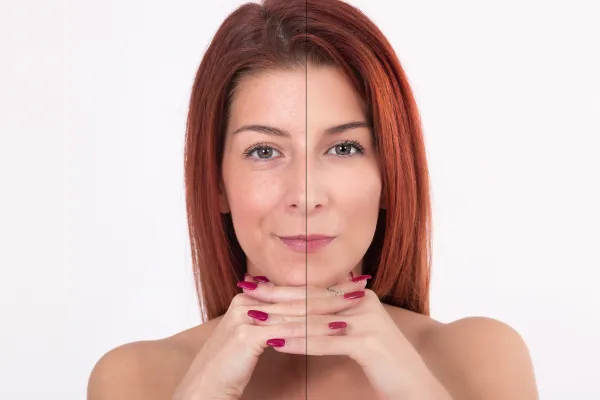 medspa skin care treatments, skin rejuvenation, look younger, better skin, younger skin
