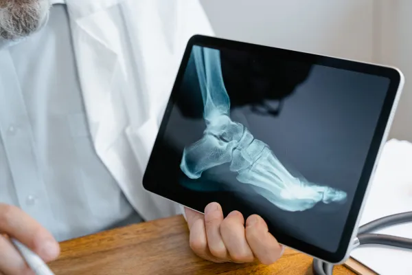 When Is Foot Surgery Needed? Here’s How to Know