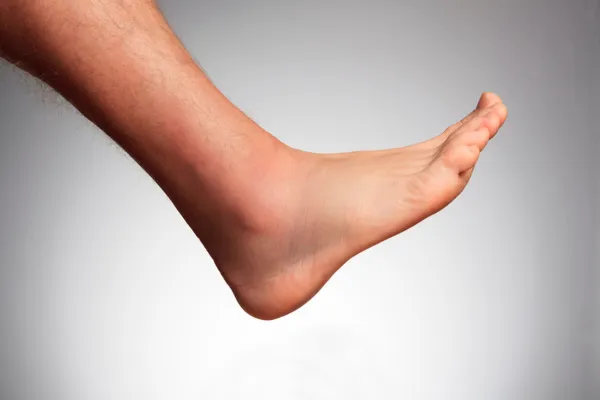 Charcot Foot: What It Is and How Podiatrists Help You Walk Again