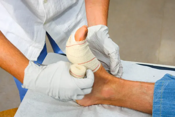 Stages of Wound Healing: What’s Normal and When to Worry