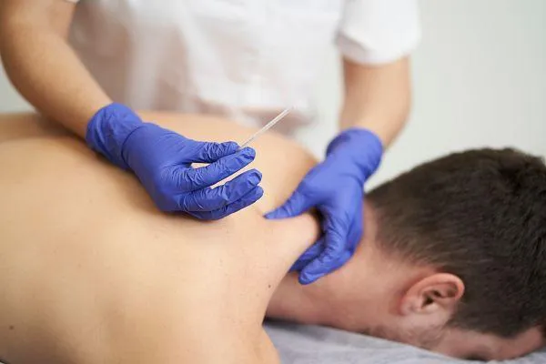 dry needling blog post cover
