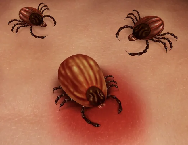 The Silent Saboteurs: Lyme & Its Coinfections
