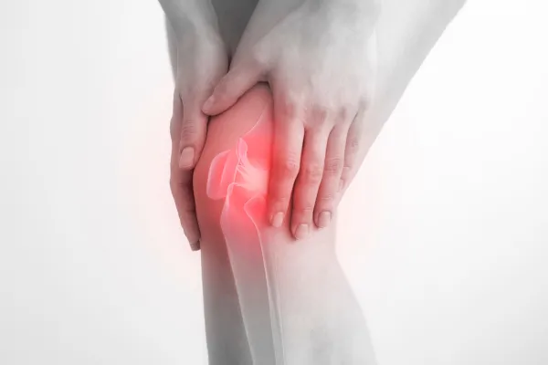 What Is Patellofemoral Pain Syndrome—and Can Physio Help?