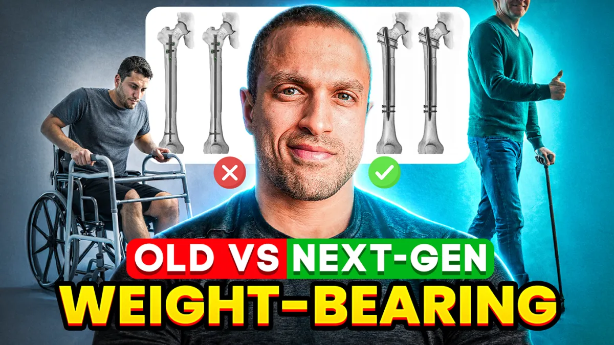 PMAX Weight Bearing Nail Benefits