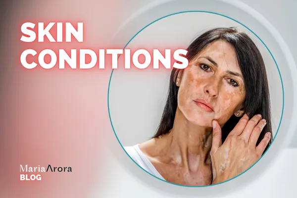 Skin Conditions