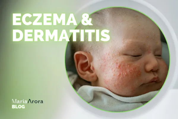 Eczema & Dermatitis
