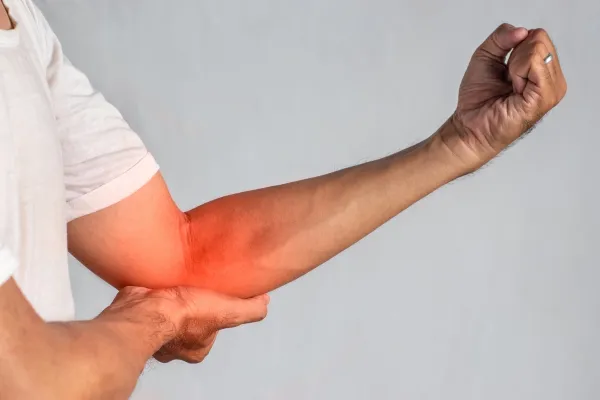 Tennis Elbow (Even if You Don’t Play Tennis): Why It Happens and What Helps