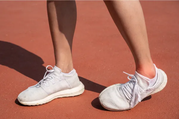 ankle sprain