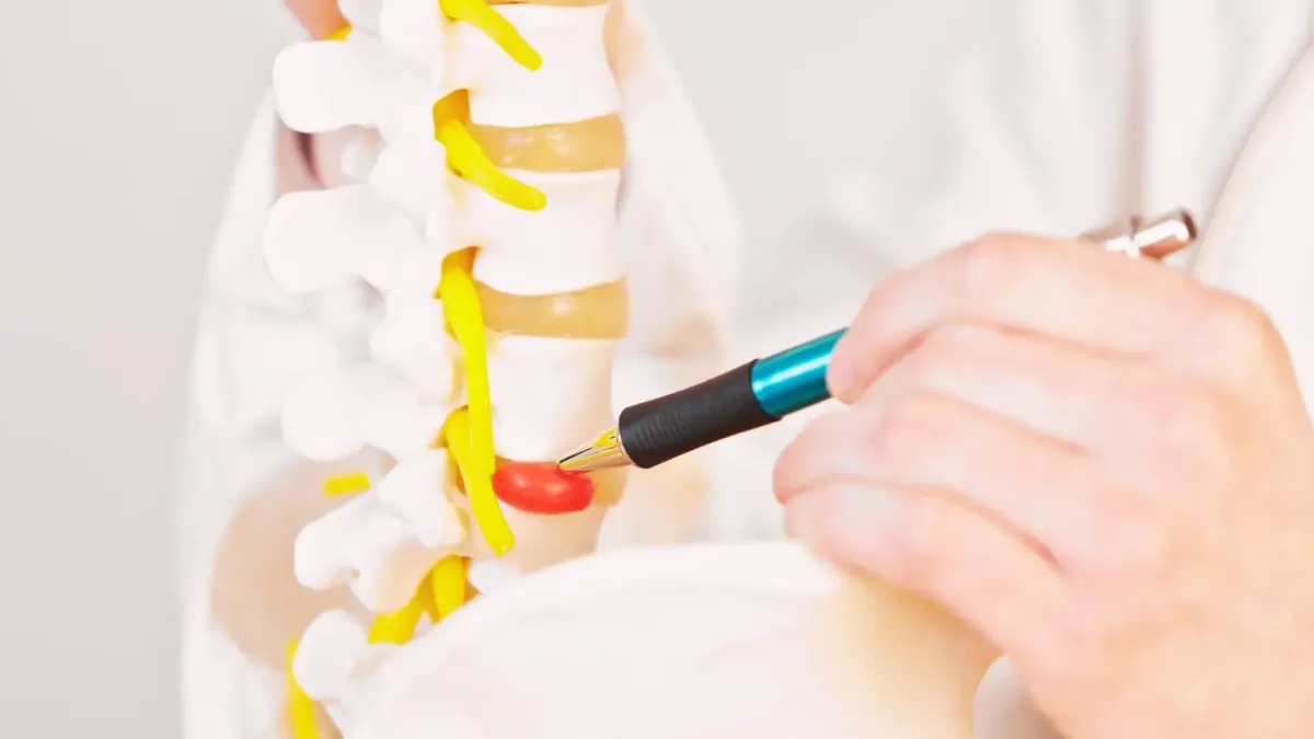 What happens if a herniated disc is left untreated?