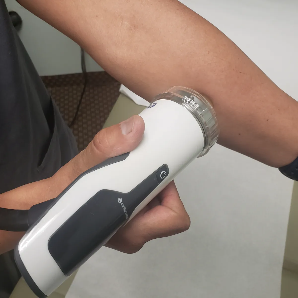 Shockwave therapy