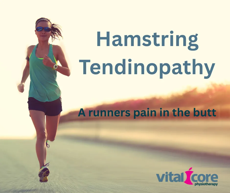 Hamstring tendinopathy – A pain in the butt