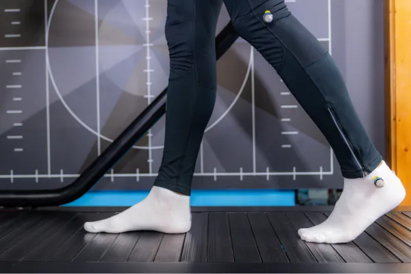 What Is Gait Analysis and How Can It Help with Sports Injuries?