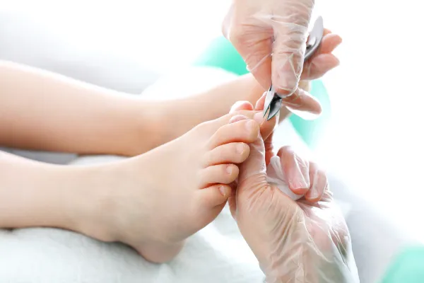 Can Ingrown Toenails Come Back After Surgery? Dublin Podiatrist Explains