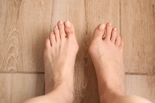 Bunions and Footwear: What Shoes to Wear (and Avoid)