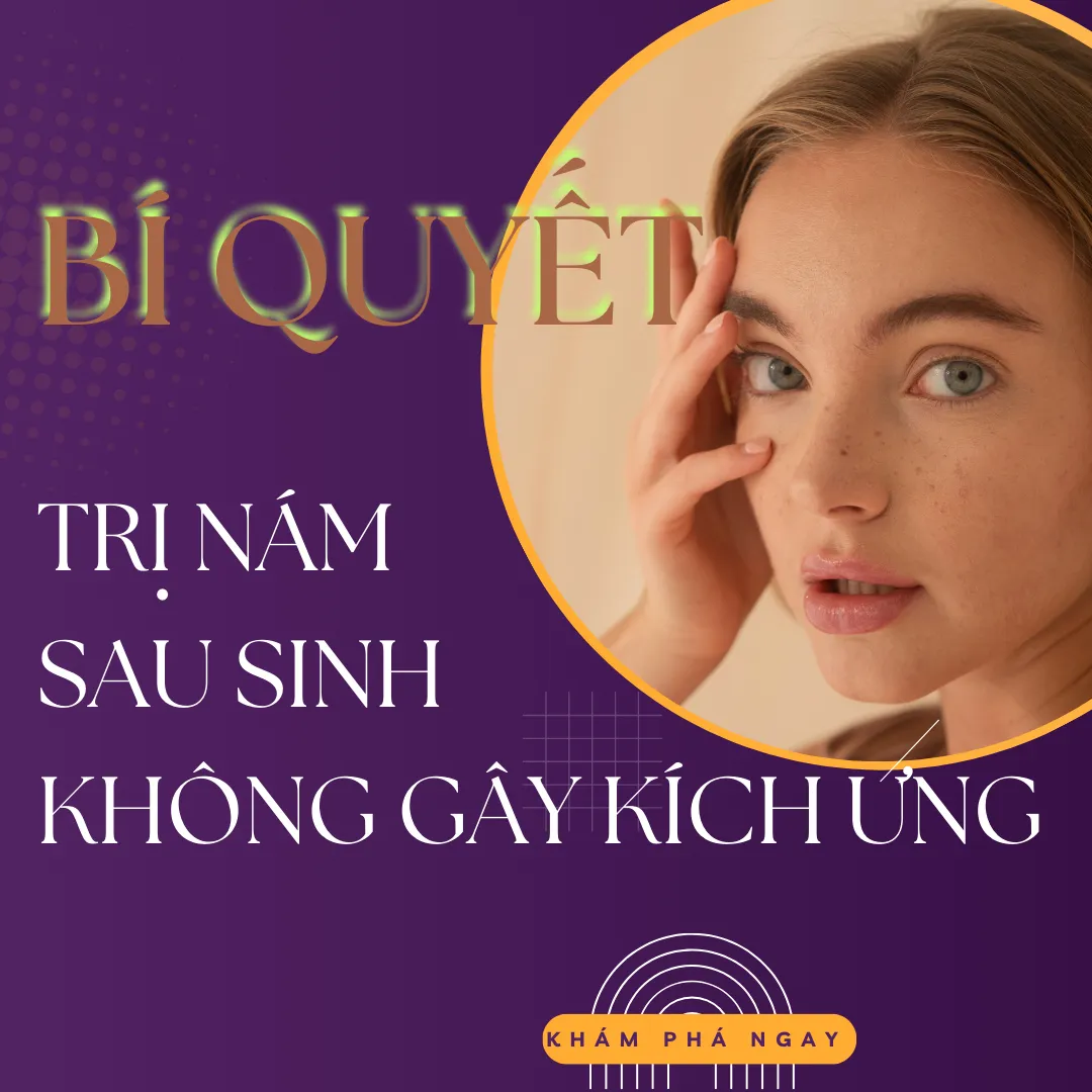 Bí Quyết Trị Nám Sau Sinh Không Gây Kích Ứng