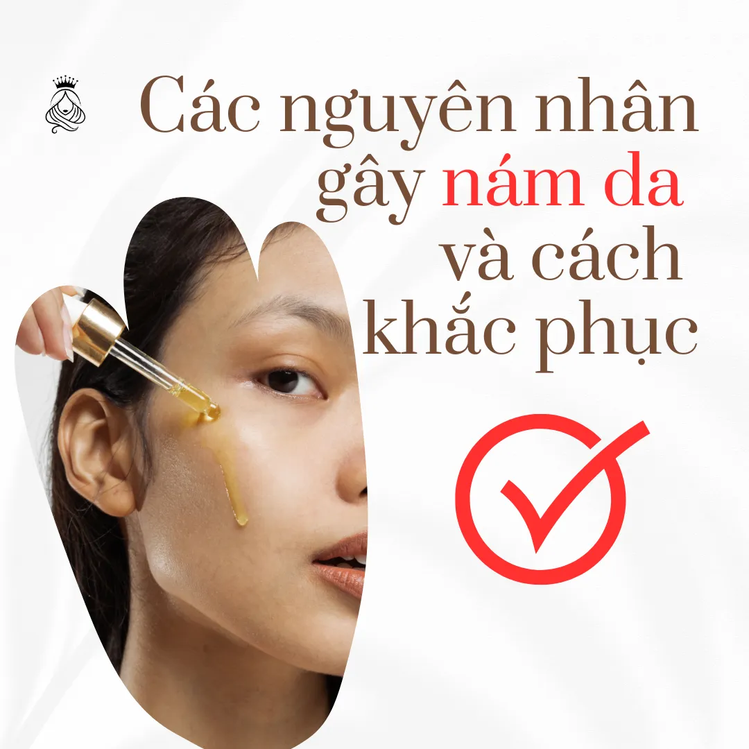Các Nguyên Nhân Gây Nám Da và Cách Khắc Phục Hiệu Quả