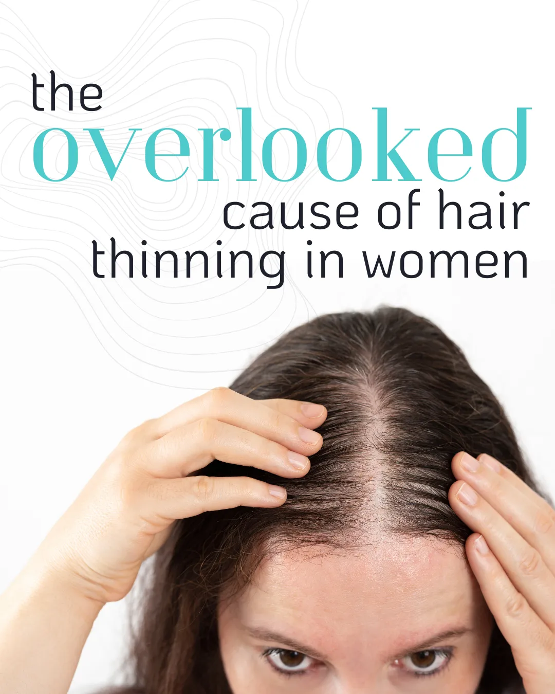 women with thinning hair 