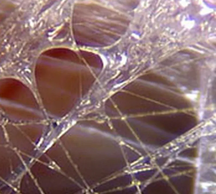 THE EMOTIONAL & ENERGETIC WEB: UNDERSTANDING FASCIA
