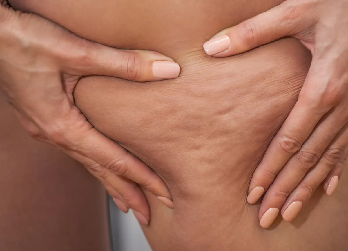 CELLULITE SUCKS. ❤️ [ a love letter to my body ]
