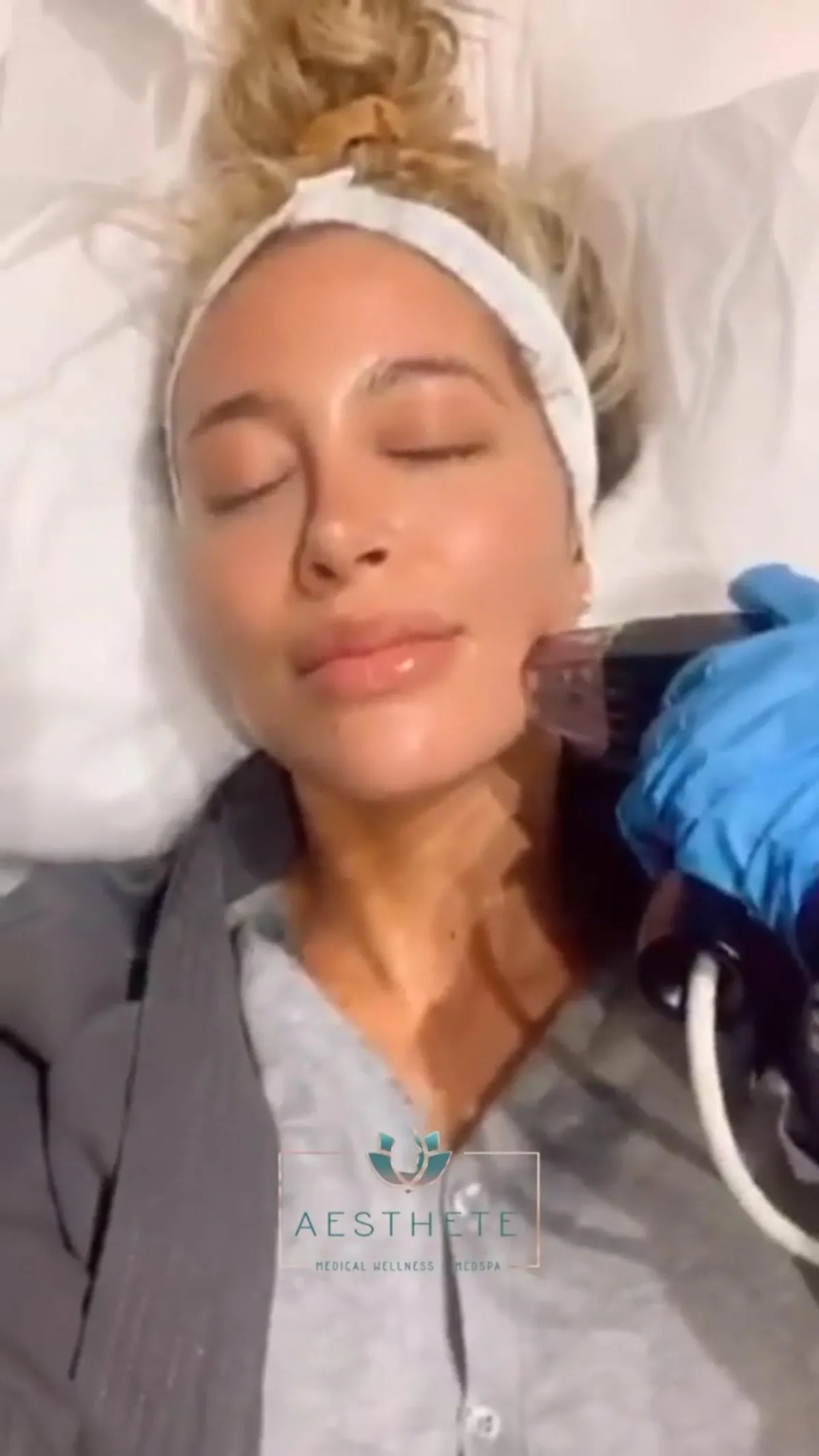 Rejuvenate Your Skin: Experience the Transformative Power of Morpheus8 at Aesthete Medical Wellness & Medspa