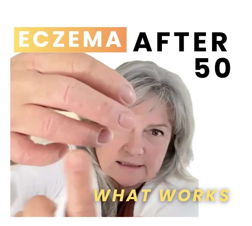 Why Did My Eczema Come Back So Bad?
