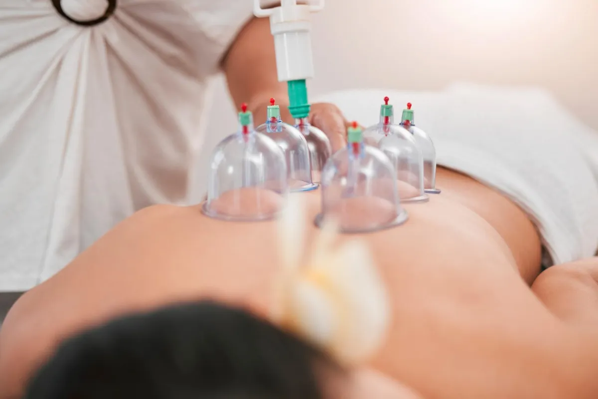 Cupping Therapy for Holistic Pain Relief & Relaxation
