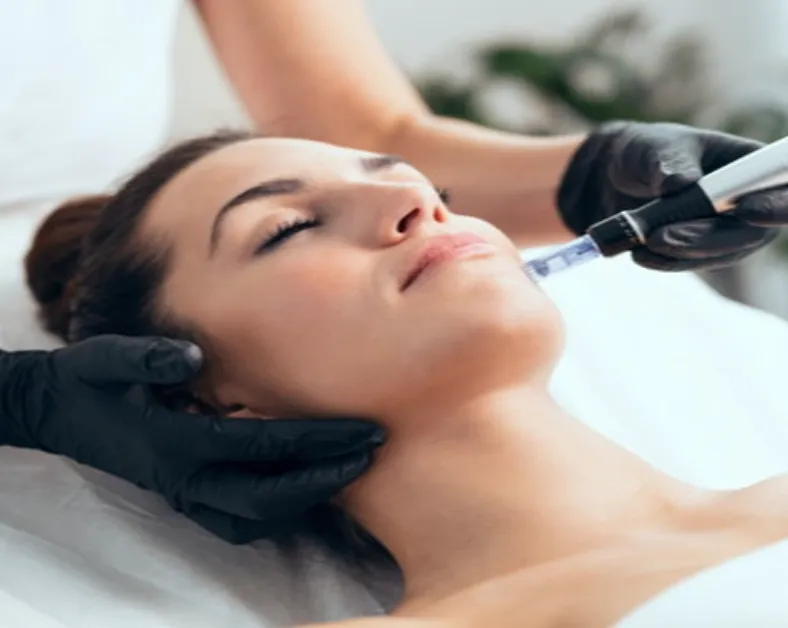 Microneedling
