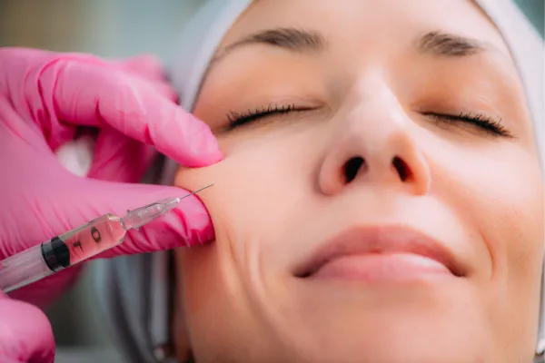 Radiesse My Skin St Pete Bradenton