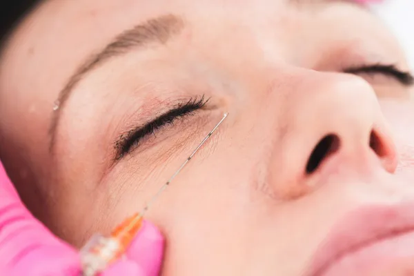 Dysport My Skin St Pete Bradenton