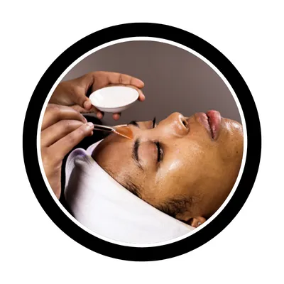 Chemical peels Fishtown Pa