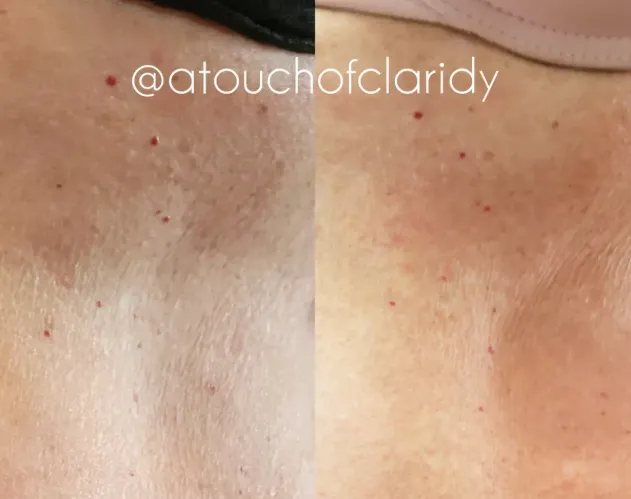 Radiant Skin