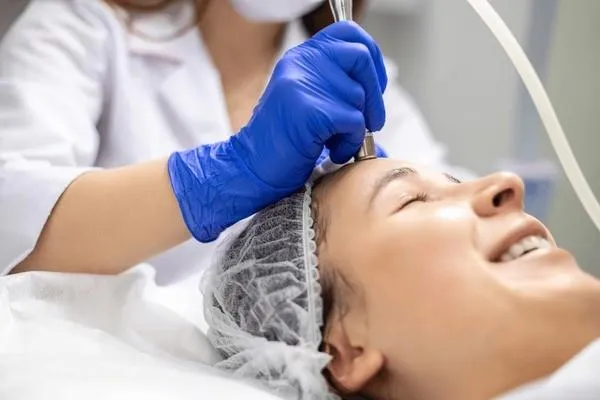 Microneedling Indianapolis