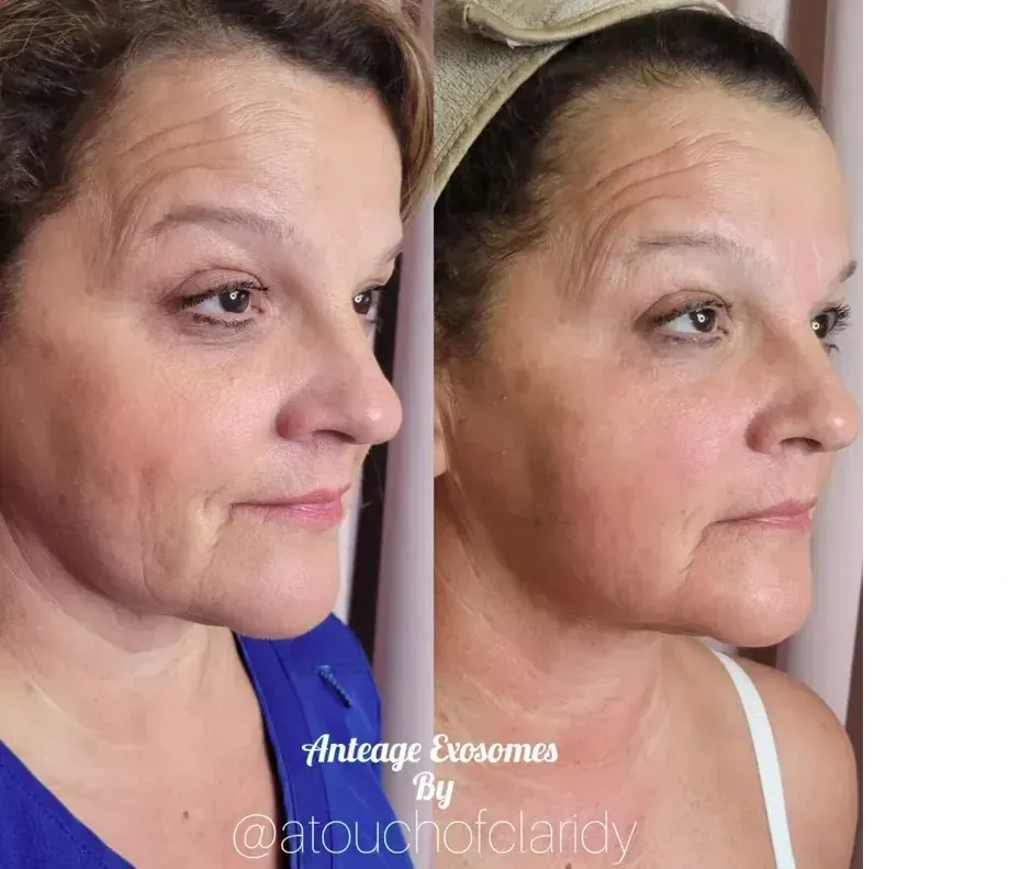 Skin Care Technician Indianapolis